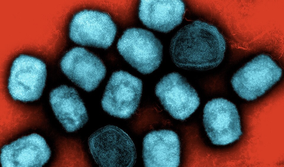 NIH Researchers Charged In Monkeypox Smuggling Scheme At Detroit Airport